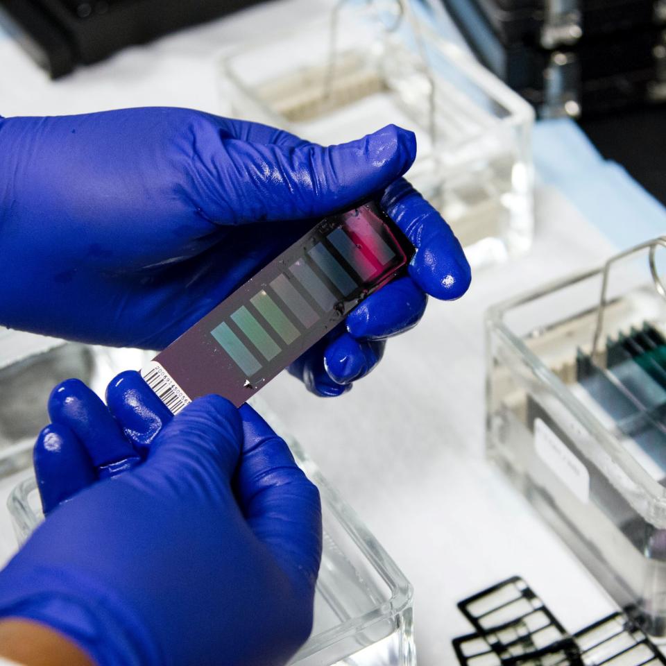 Gloved hands holding medical test equipment